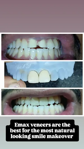 Pooja Smile Care Dental Gallery Image 16